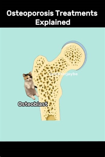 Bisphosphonates: Wirkung und Risiken bei Osteoporose