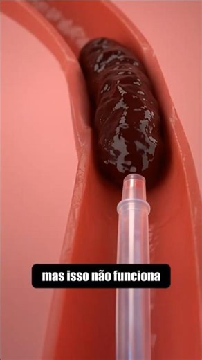 Isso Pode Salvar sua Vida