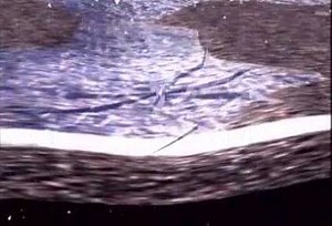 Potholes are at their worst in the spring. But do you know why? Watch this one minute video to learn the science. If you encounter a pothole on a state highway or interstate, please report it through our online form: mndot.gov/information/potholes/reporting.html Using the form helps us quickly identify trouble areas and get the information to our local maintenance crews. | Minnesota Department of Transportation