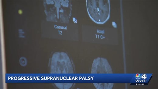 Progressive supranuclear palsy and how awareness of the disease can move toward more therapies