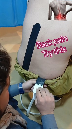 “Sciatica Pain Gone in 60 Seconds👆 Try This Tapping Hack😱🔥 #stretchreflex #viral #backpain #shorts