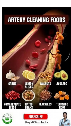 Artery Cleaning Foods | What Actually Dissolves Plaque #arterycleanse #cholesterolmanagement #foods