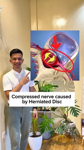 Relieve lower back tension in just 1 minute! 🧘‍♀️Place a rolled towel under your lumbar spine to restore your natural curve, ease muscle tightness, and support spinal alignment. Great for those who sit a lot or feel stiff. Try it for 30 sec to 1 min!#LowerBackRelief #PostureFix #SpineHealth #StretchDaily #PhysicalTherapyTips | Physical Therapy Session