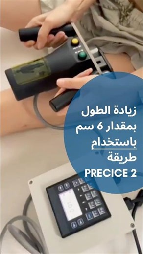 زاد طوله 6 سم! كيف تعمل عملية زيادة الطول بتقنية PRECICE 2