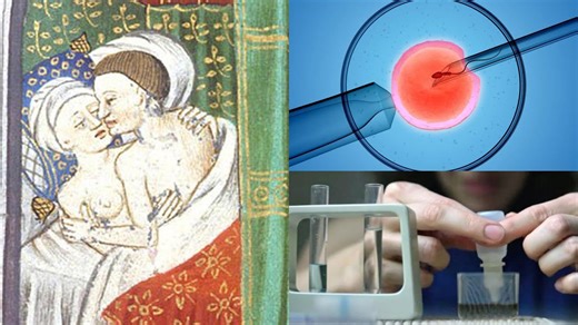 A history of childbirth: conception