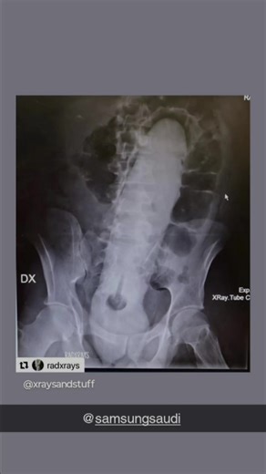 Amanda Landry on TikTok