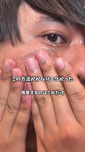 ハイドロキノンでスキンケア革命を！