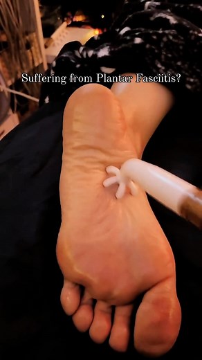 18K views · 84 reactions | Suffering from the struggle of Plantar...