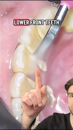 This Is Why Teeth Are Sensitive