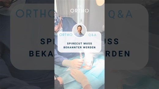 Helft uns, die Spirecut-Methode bekannt zu machen! 🤝 | Spirecut