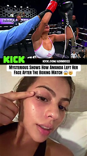 Mysterious Shows The Damage Amanda Did To Her😱🤯#amandasolis #mysteriousaileah #fyp