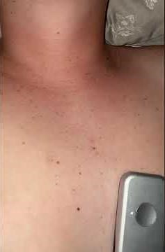 Female Heartbeat and Visible Pulse