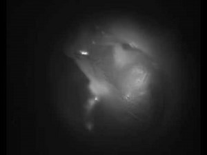 Imaging inner ear using shortwave infrared