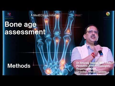 Bone Age Assessment Methods
