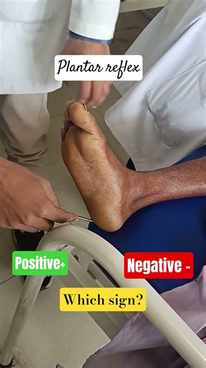Plantar reflex