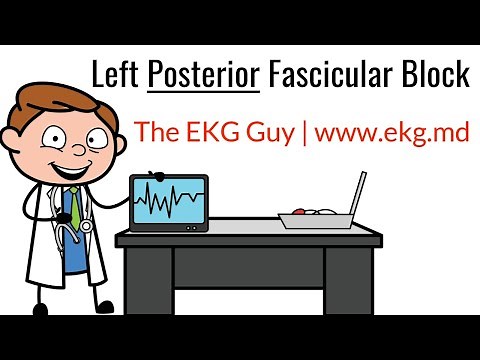 Left Posterior Fascicular Block on EKG / ECG l The EKG Guy - www.ekg.md