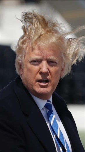 What's up with Trump's hair?