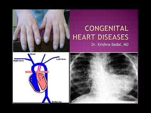 Congenital heart diseases