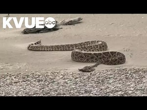 Doctor shares tips to avoid snake bites and what to do if you get bitten