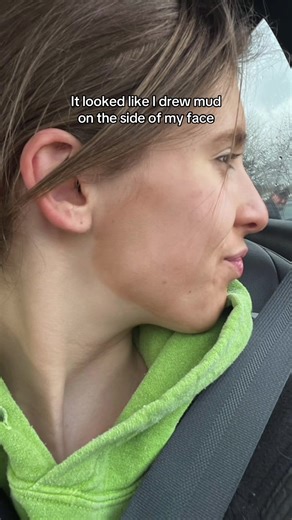 Overcoming a Bad Tan: Tips and Tricks