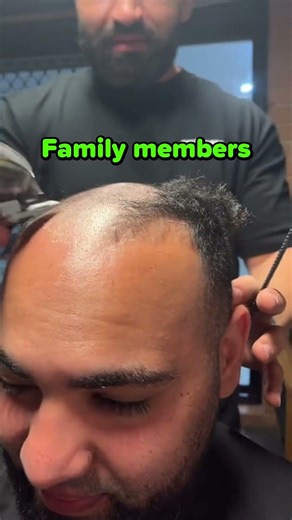 They All Shaved Their Heads for Her ❤️