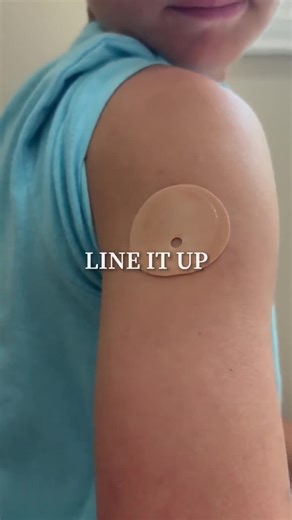 Glucomart Dexcom G7 Underpatch With External Adhesive – Skin-friendly, Extra Secure Fit, Perfect Needle Alignment (10 Pack) - Etsy