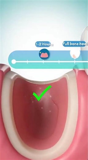 🦷 How Long Does Tooth Extraction Healing Take?