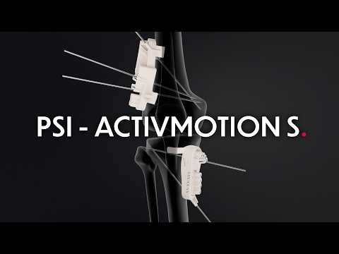 Activmotion S - Patient Specific Instrumentation - Surgical technique