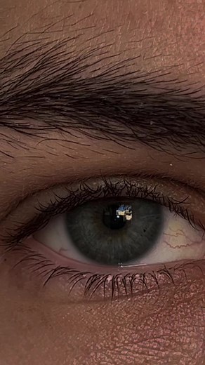 Discovering Eye Worms: What You Need to Know