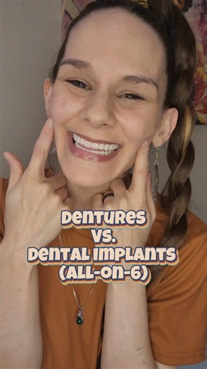 Dentures vs. Dental Implants - Comparing How They Feel! It really is Night & Day when comparing how Dentures and Dental Implants feel in your mouth. I have nothing covering the roof of my mouth anymore, and my implants and arch of teeth are so much smaller. They feel so similar to natural teeth! I'm so glad I had the BEST team working on my smile during this process, too - @JAX Implants & Dentures #dentalimplants #denturegang #toothless #dentaltok #dentures