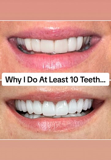 Teeth Transformation: A Comedy Duo in Dentistry