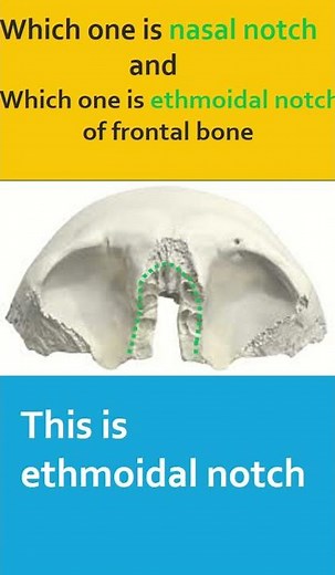 Nasal notch and ethmoidal notch of frontal bone #shorts #anatomy