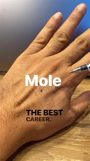 Understanding Palmistry: The Meaning of Moles on Hands