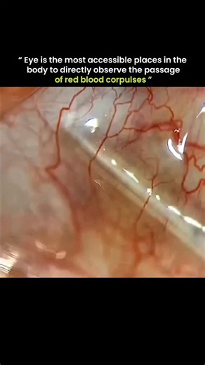 know Universe on Instagram: "The eye is indeed a uniquely accessible location for directly observing retinal blood vessels and, via specialized imaging, the movement of red blood cells (RBCs) in a living person, providing a non-invasive, direct view of the cardiovascular system. Techniques like flood-illumination adaptive optics (FIAO) allow for the visualization of individual RBC flow in human retinal capillaries. We do not own any of the content. All credit goes to the respective owners. No co