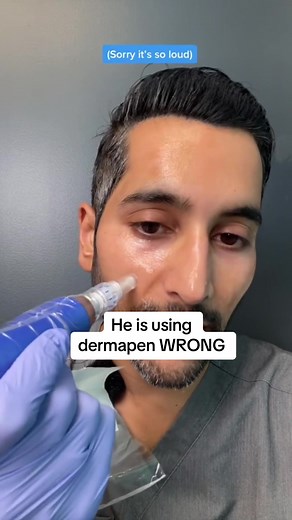 Microneedling: The Right Way to Use a Dermapen