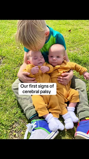 Recognizing Early Signs of Cerebral Palsy