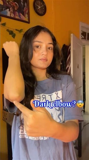 how to clean elbow | how to clean elbow darkness | dark neck home remedy | elbow black remove