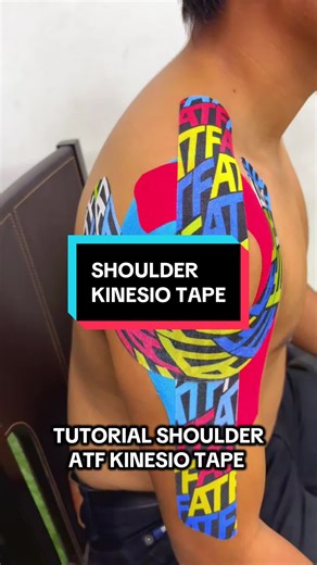 Effective Shoulder Taping Techniques for Athletes