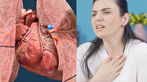 How a blood clot reaches the lungs