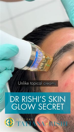 Drs Tatiana + Rishi Mandavia: Advanced Aesthetics on Instagram: "Let’s get RF microneedling + topical exosomes with Dr Rishi ✨ The (not-so) secret combination behind his glassy, lit-from-within skin 🤐⚡️👨🏻‍⚕️ Why this combo works 👇 RF microneedling creates precise micro-channels and heat in the dermis to tighten + remodel collagen. We then layer topical exosomes - cell-derived signalling vesicles packed with peptides, growth factors and antioxidants - to amplify recovery, glow and skin qualit