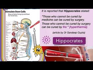 What is Iteracare therapy device? The Science.