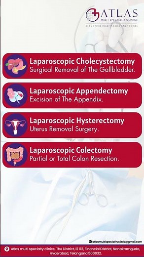 What Are Laparoscopic Procedures? Explained in Seconds #shorts