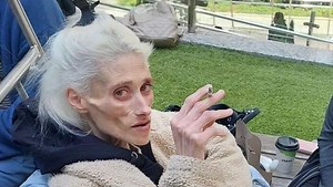 הטרגדיה של קארין באומן: "אוכל הוא רק הסימפטום" | כל סימני האנורקסיה