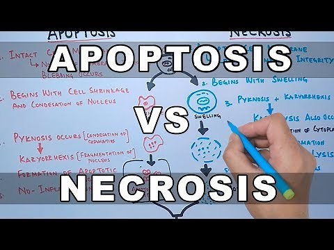 Apoptosis vs Necrosis