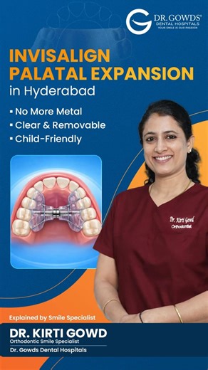 Best Invisalign provider in Hyderabad | Comfortable, Clear, and Effective!
