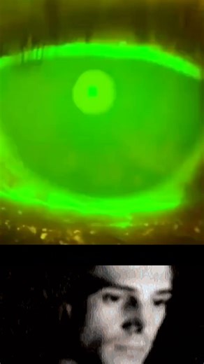 How Fast Your Eyes Dry Between Blinks 👁️💧