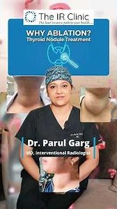 Why Thyroid Nodule Ablation Is Getting Popular? 🦋 | No-Surgery Thyroid Nodule Treatment