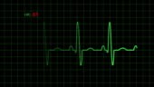 Realtime EKG heart monitor with