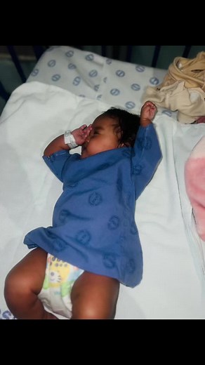 Amniotic band syndrome is a broad term for a group of congenital abnormalities that occur when bands of amnion (the inner lining of the amniotic sack or