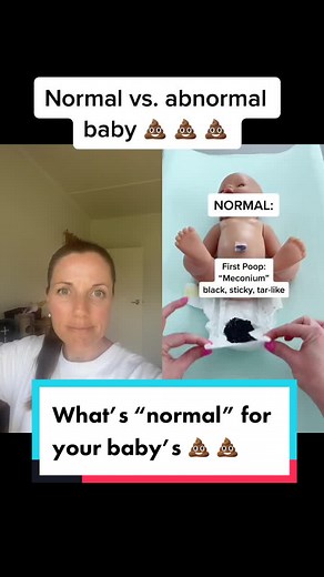 Understanding Baby's Poop: What's Normal vs. Abnormal